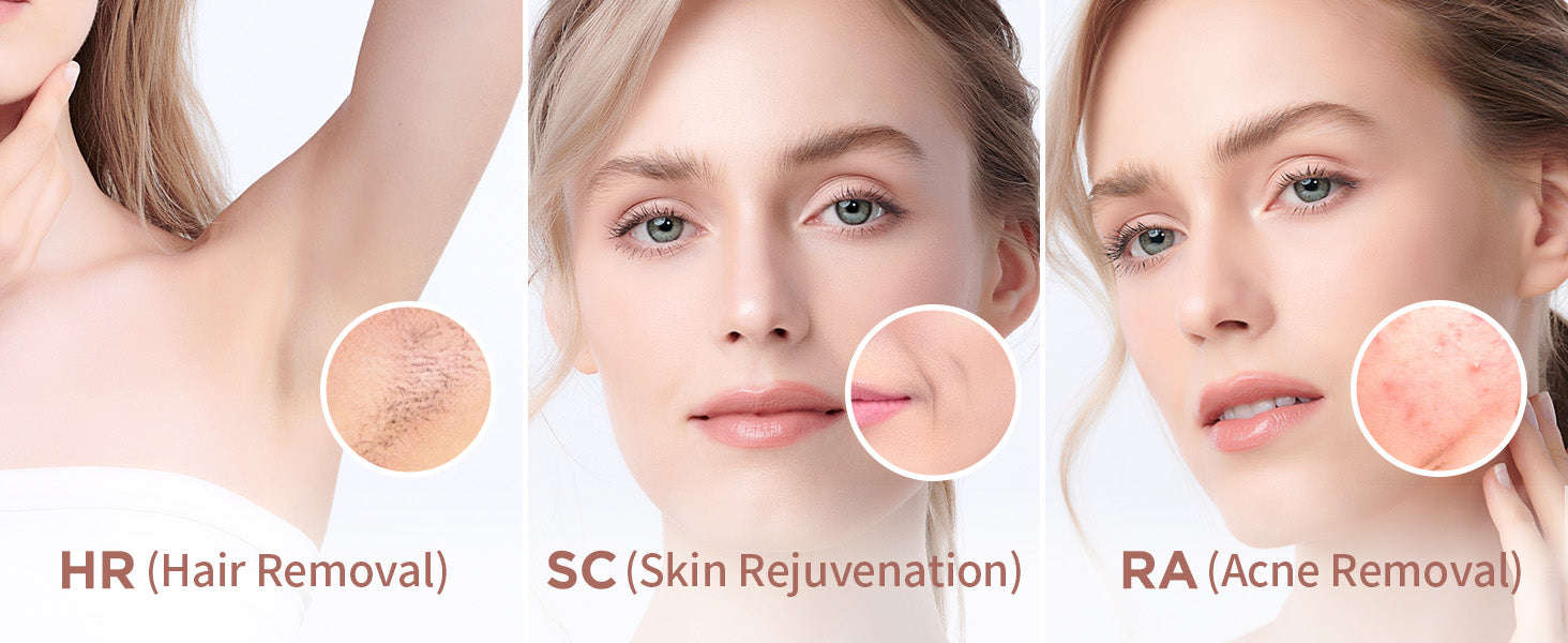 IPL Hair Removal Device with 999,900 Flashes for Full-Body Use-AI01D / US Plug / United States