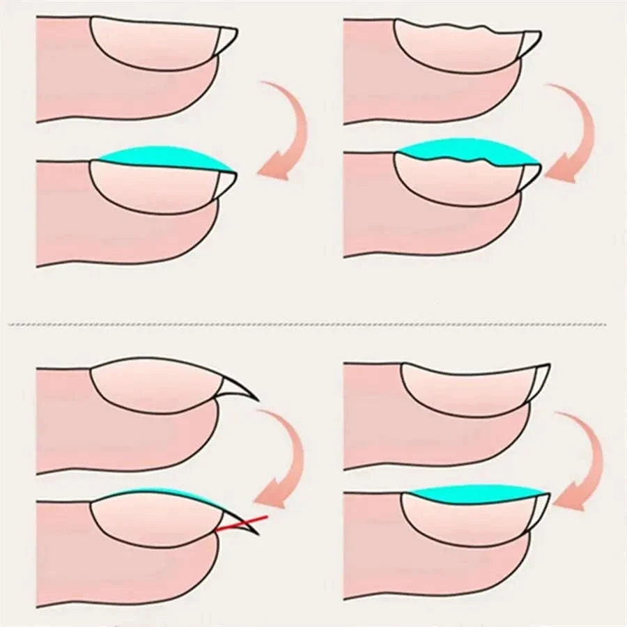Long-Lasting Base Coat & Top Coat Nail Reinforcement Gel-2set Base Coat