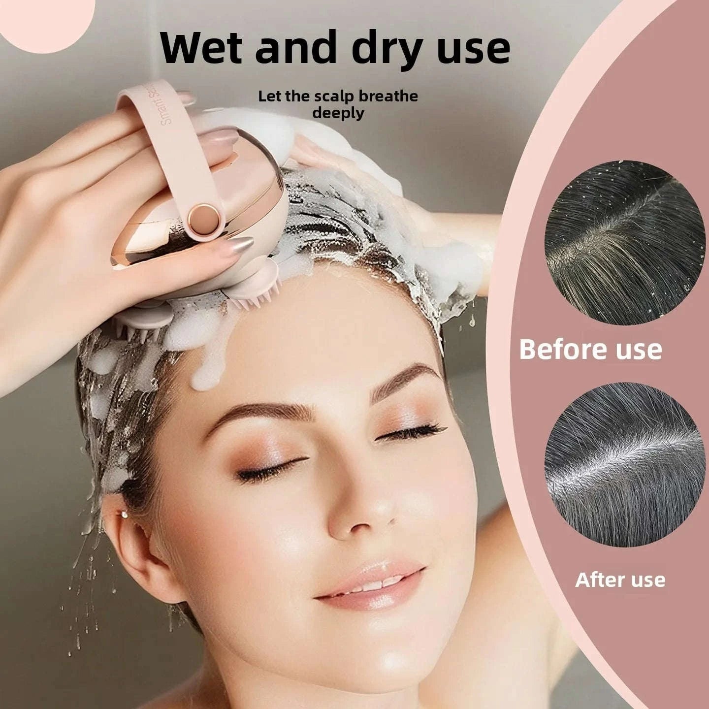 Rechargeable Scalp Massager for Stress Relief and Relaxation-United States