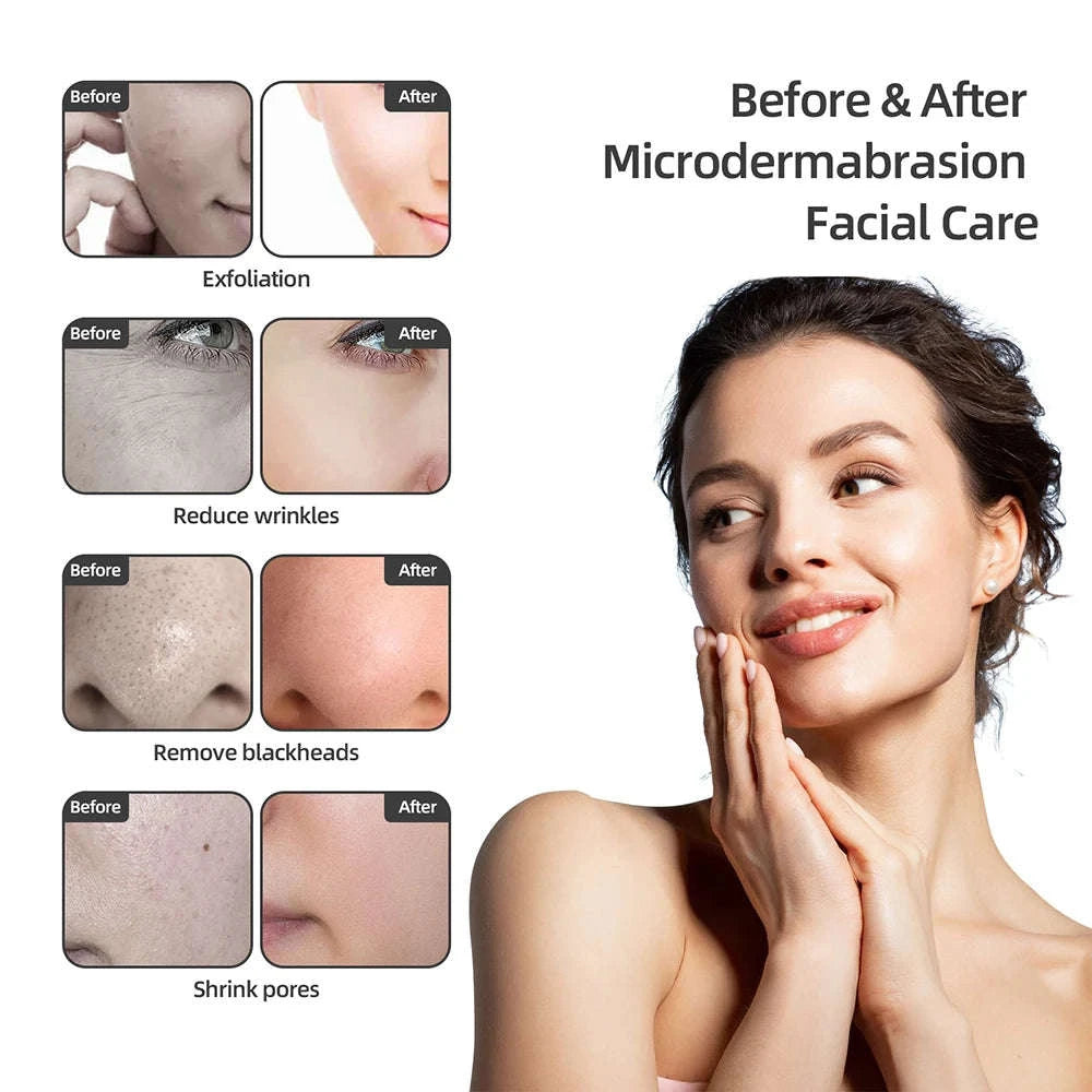 Spa Facial Deep Cleansing Device-White / United States