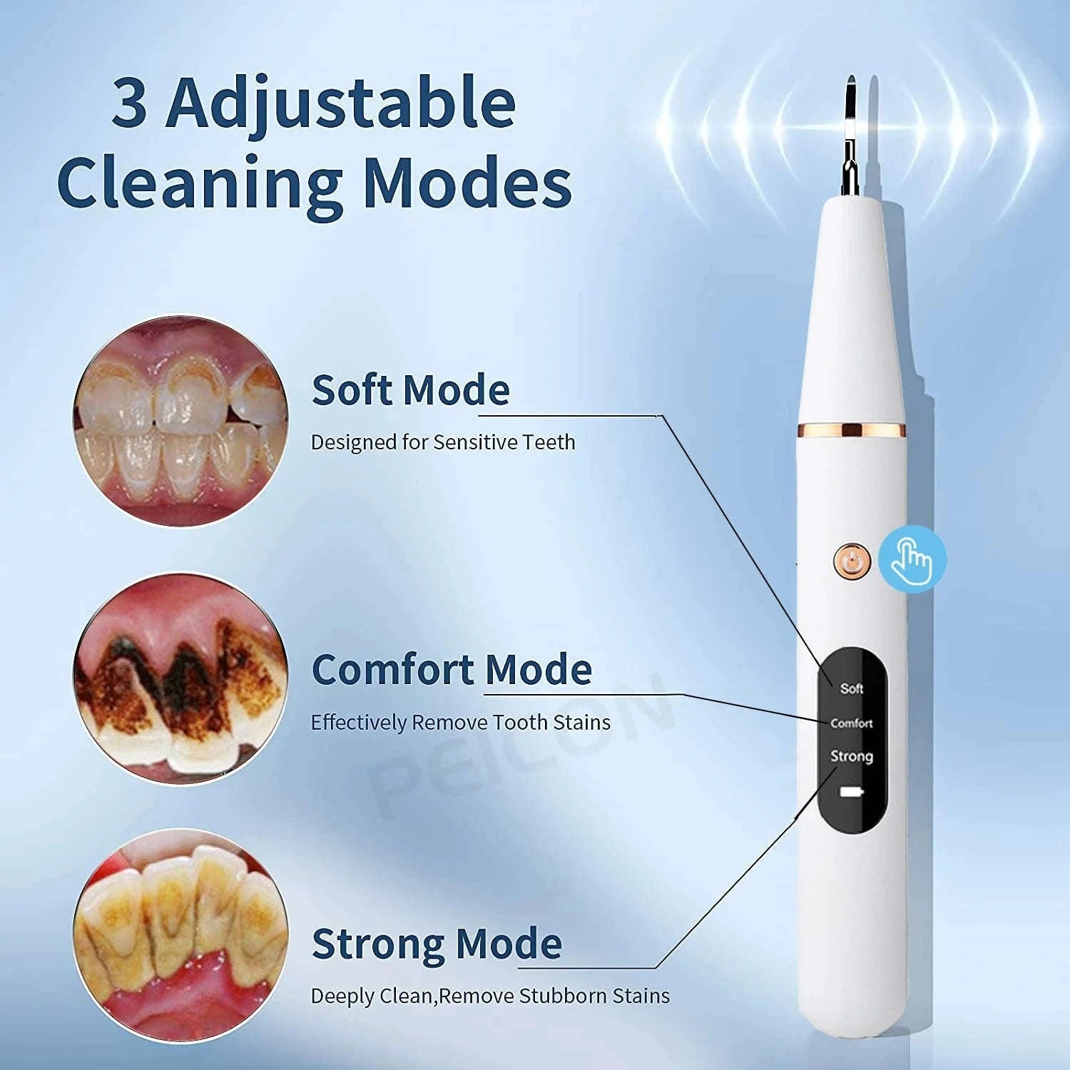 Ultrasonic Dental Cleaner – Electric Plaque & Tartar Remover-White add 4 tips