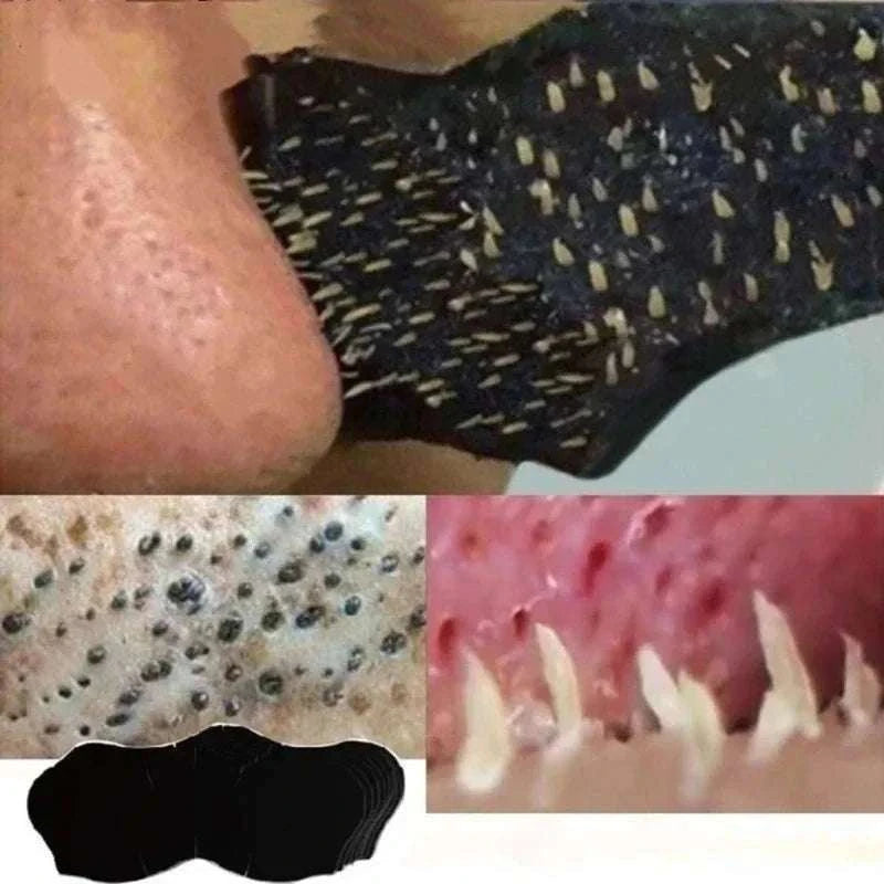 Unisex Blackhead Removal Nose Strips-C678-25pcs