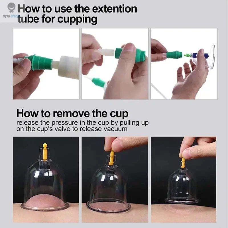 Vacuum Suction Cups for Body Massage and Relaxation-24pcs