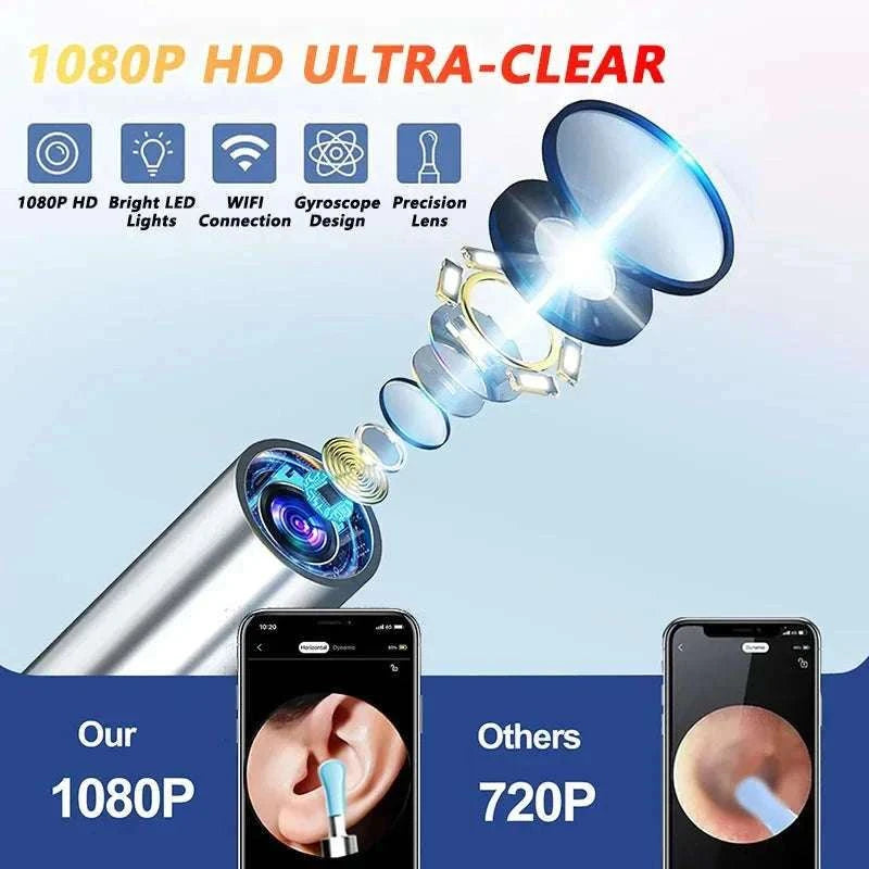Visual Ear Wax Cleaner with Camera – Smart Ear Care Kit-NE3-D Basics White