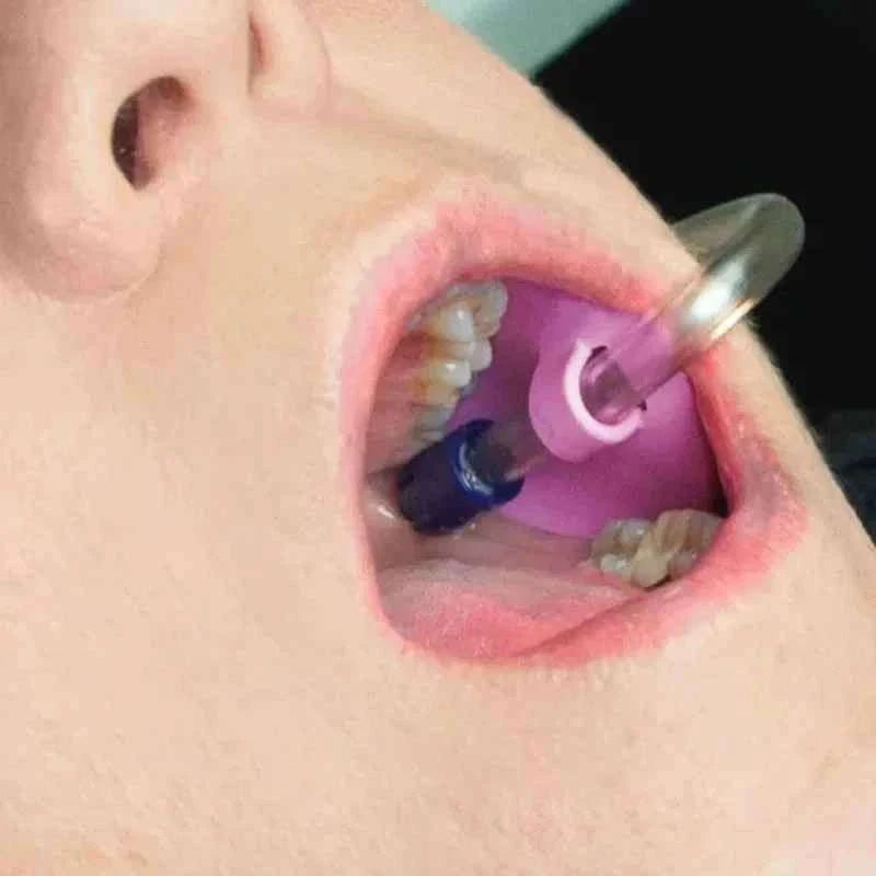 10-Piece Autoclavable Dental Suction Tube Holder-Default Title