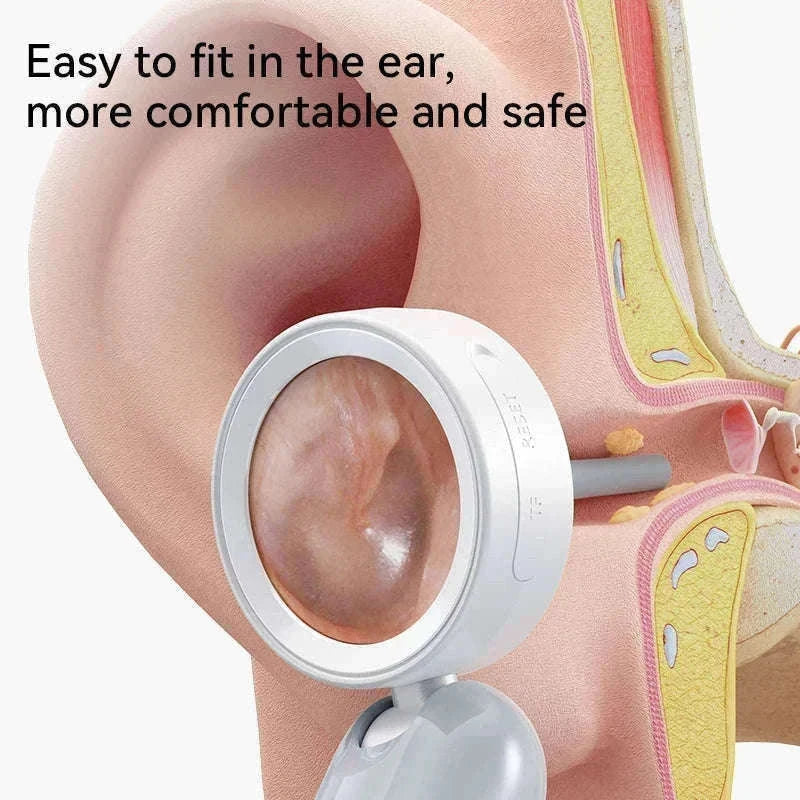 1080P Otoscope Ear Camera with Screen and LED Lights for Clear Inspection-WHITE / United States