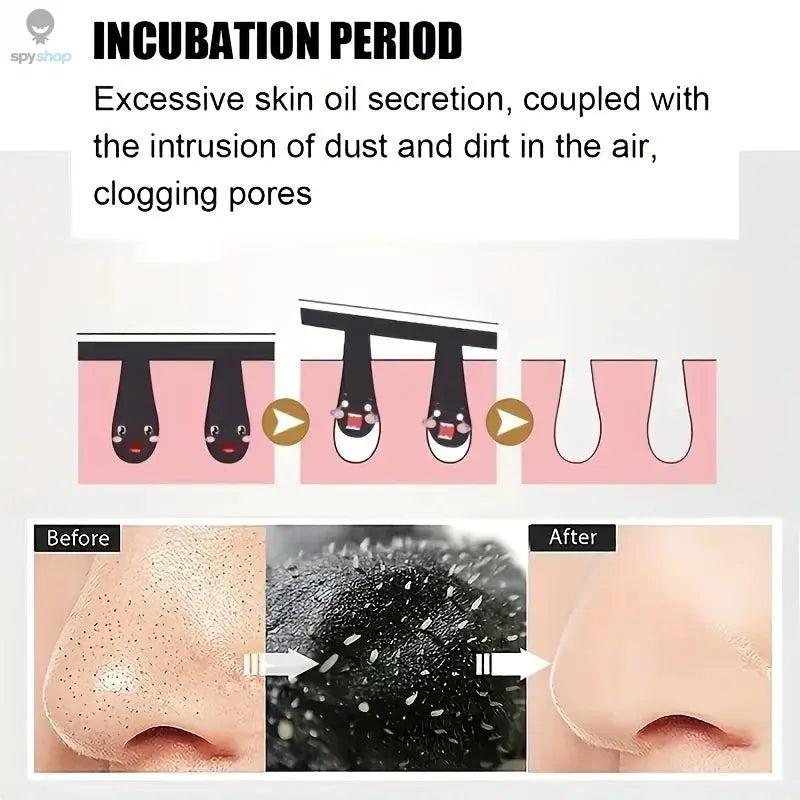 15pcs Blackhead Nose Strips Deep Cleansing Nasal Spot Facial Dot Stickers Nose Mask Shill For Acne & Black Head - Dropship Spy-shop.com