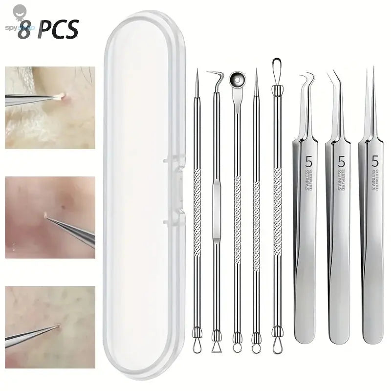 8-Piece Blackhead Remover Kit – Stainless Steel Blemish & Acne Extraction Tools – Professional Pimple Popper Set for All Skin Spy-shop.com