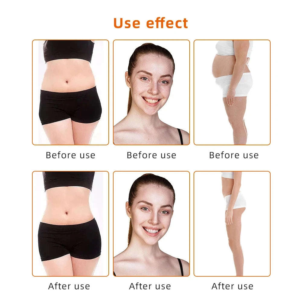 9-in-1 40K Cavitation Body Slimming Machine-US PLUG / US Plug / United States