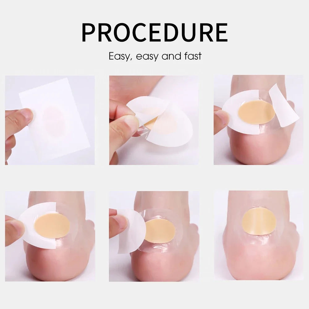 Fersenprotektor Fußpflaster – Hydrocolloid Blasenpflaster für komfortable Fußpflege