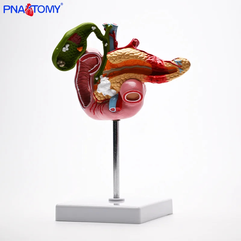Gallbladder, Pancreas and Duodenum Pathology Teaching Model