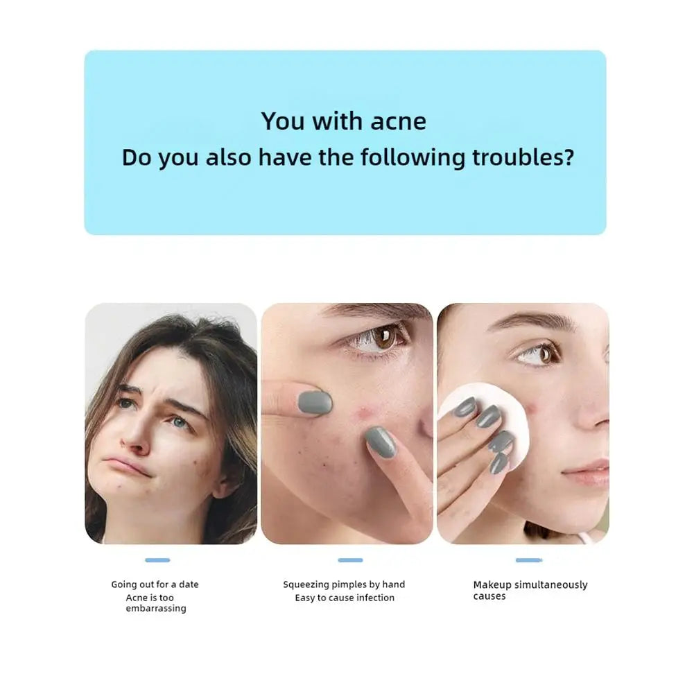 Blue & Yellow Stars Hydrocolloid Acne Patches with Mirror Storage Box