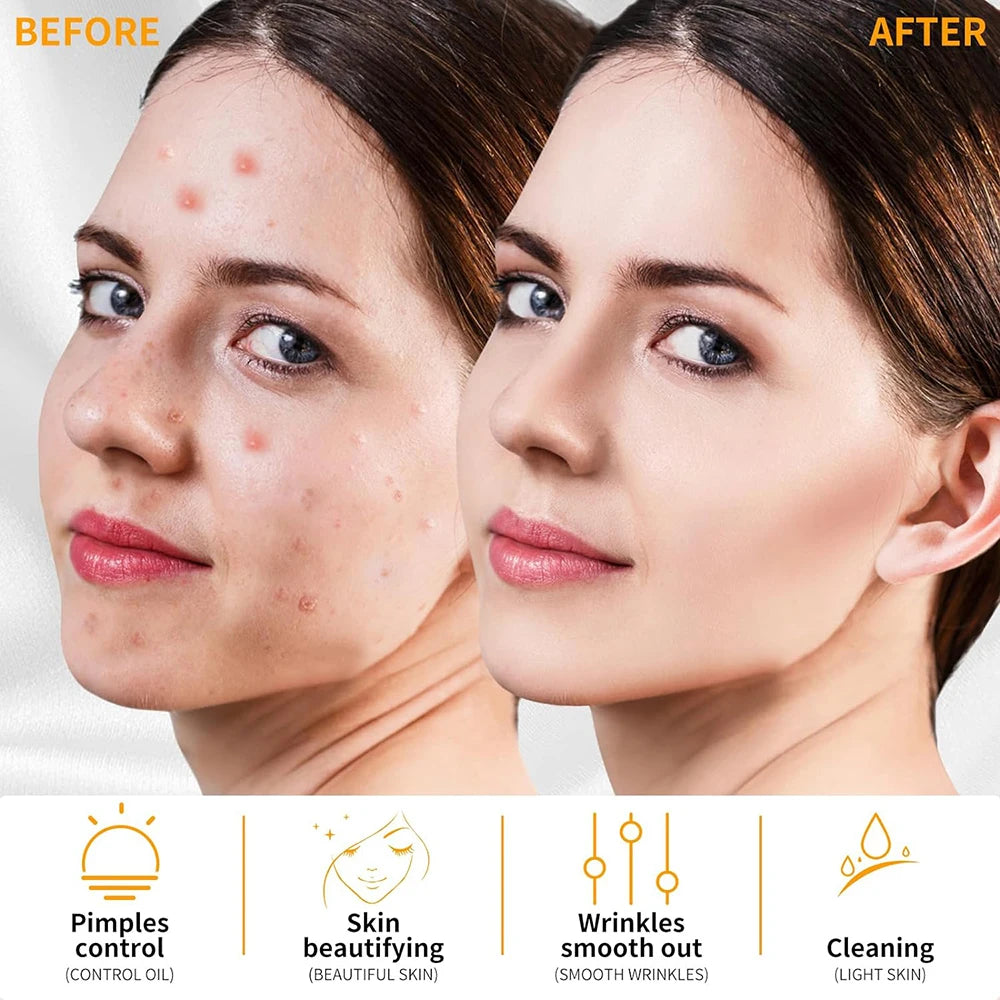 Wysokoczęstotliwościowa elektroterapia do twarzy do odmładzania skóry