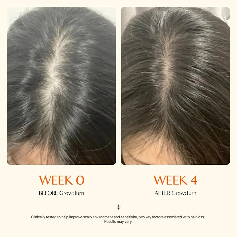 Hair Growth Serum Ampoule for Scalp Care, Anti-Hair Loss & Thinning Treatment, 100ml
