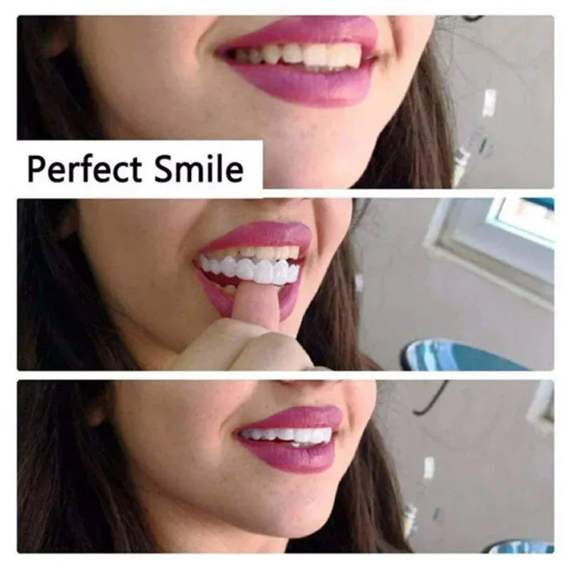 Temporary Silicone Cosmetic Tooth Covers, Upper or Lower