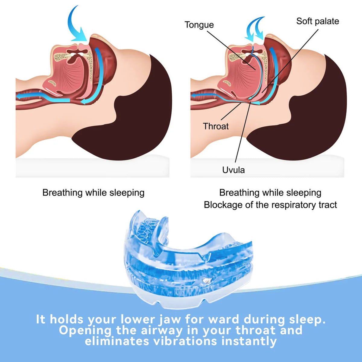 Protège-dents anti-ronflement et bruxisme Appareil anti-ronflement Aide au sommeil pour bruxisme et apnée Protège-bouche de nuit anti-ronflement