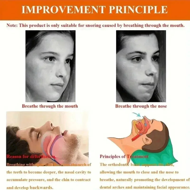 Anti-snoring Band Open Mouth Breathing Corrective Anti-snoring Chin Rest Sleep Open Mouth Rest 