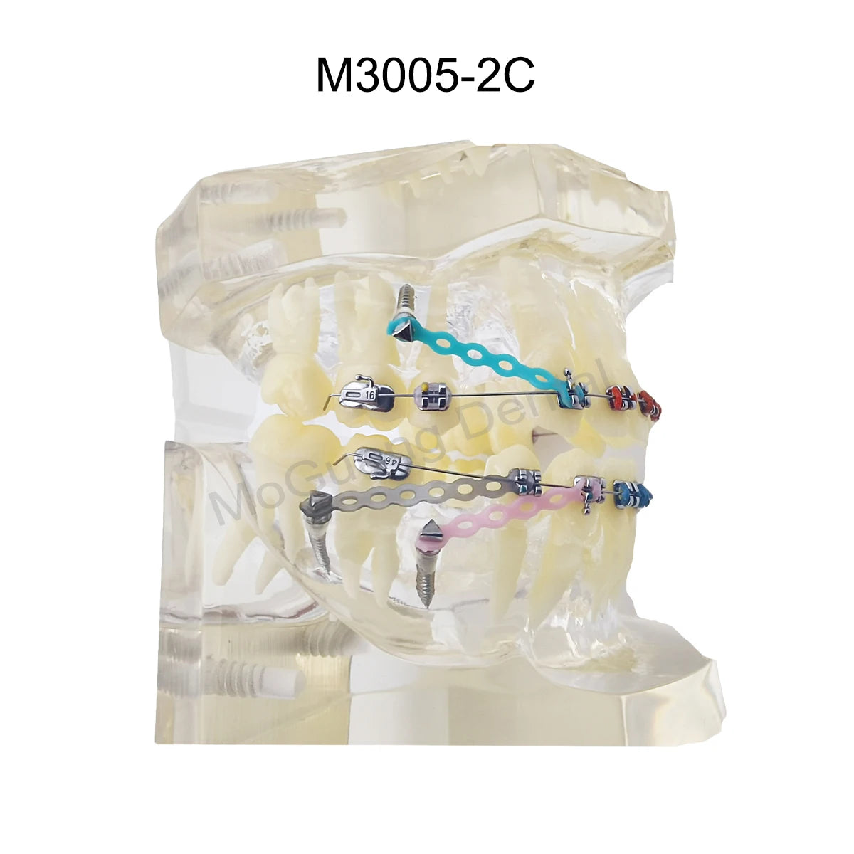 Dental Orthodontic Teaching Models and Cheek Simulator Options