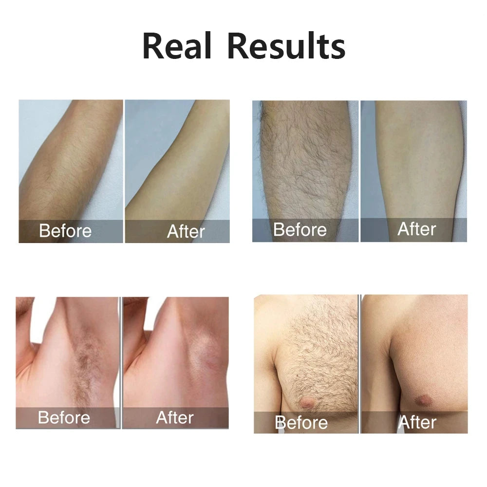 Laser Epilator IPL Hair Removal For Women Body Bikini Facial 990000 Flashes Permanant Painless IPL Hair Remover Laser Epilator 