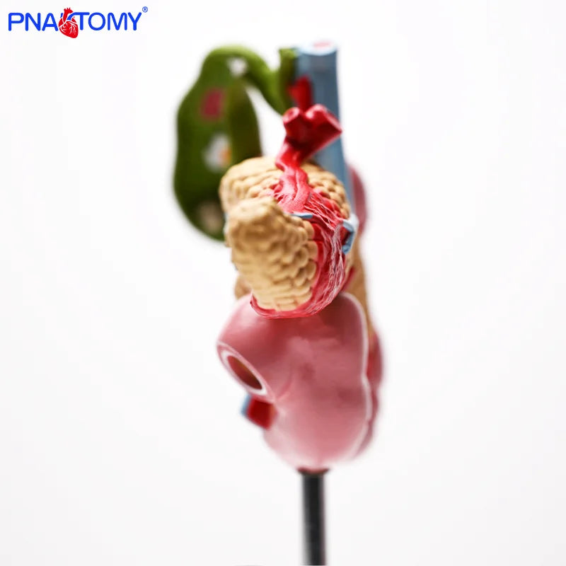 Gallbladder, Pancreas and Duodenum Pathology Teaching Model