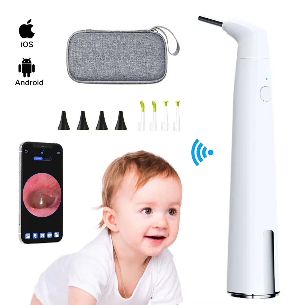 Wireless Otoscope - Camera and Accessory Options