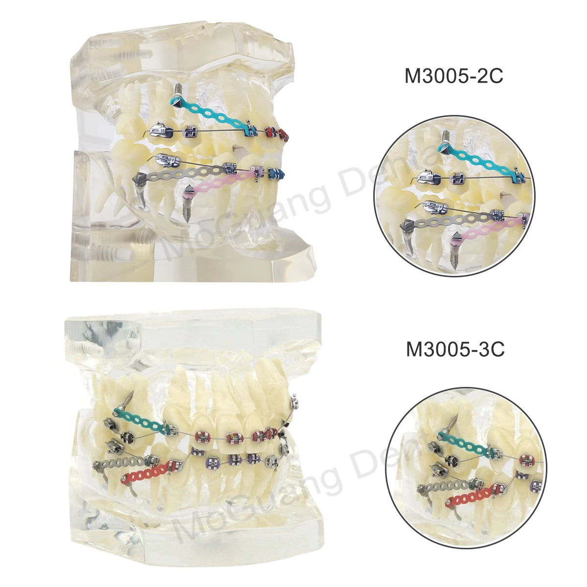 Dental Orthodontic Teaching Models and Cheek Simulator Options