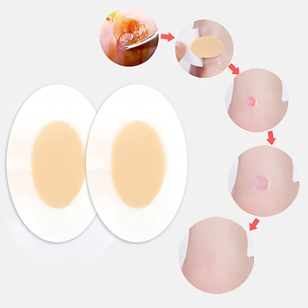 Fersenprotektor Fußpflaster – Hydrocolloid Blasenpflaster für komfortable Fußpflege