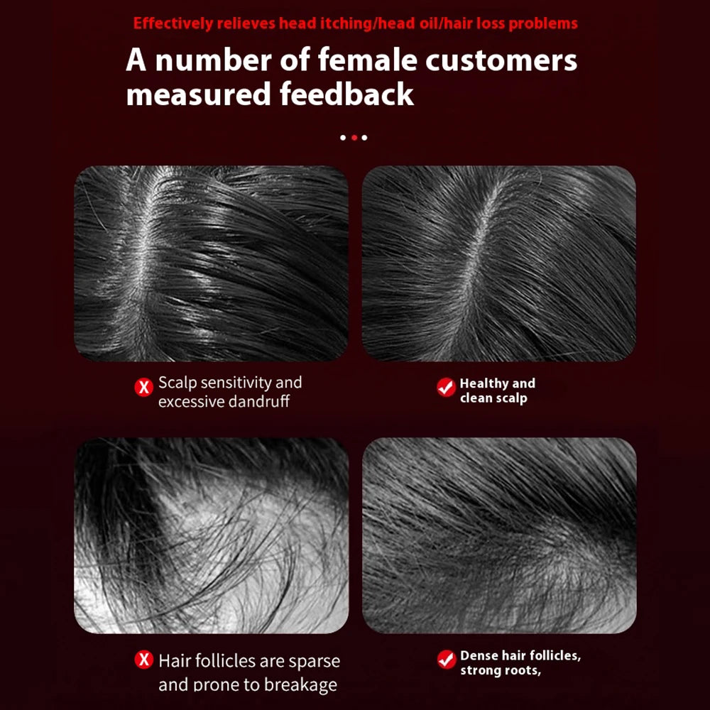 3 Modes Electric Massage Comb Portable Red Light Laser Comb for Hair Follicle Hair Follicles On The Head Essence Oil Applicator 