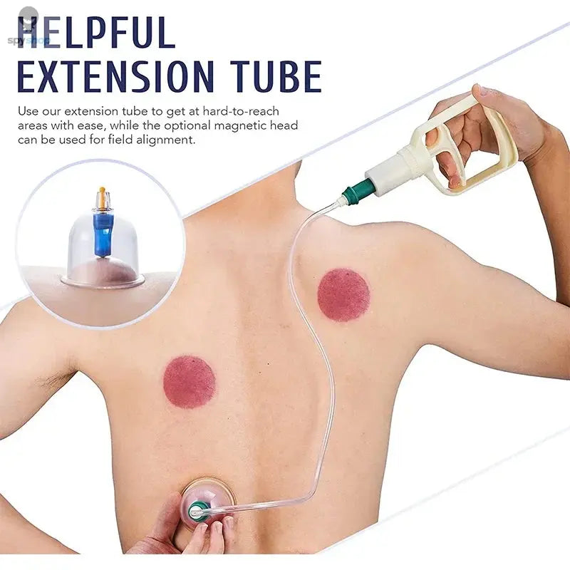 Tuhopeta 6/12/24 Pieces Suction Cups Massage Vacuum Cupping Body Massager Plastic Vacuum Suction Therapy Cupping Set Cans 