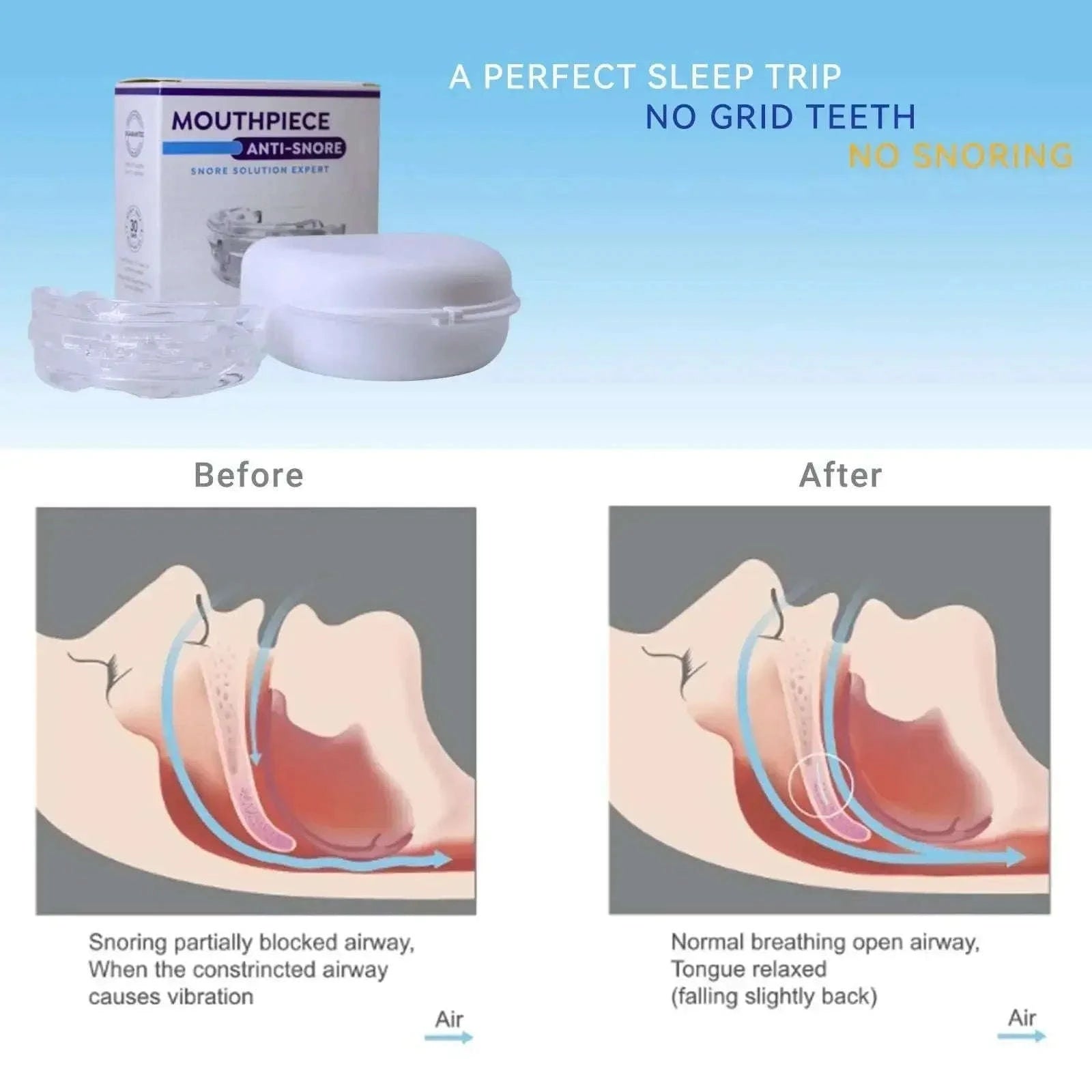 Adjustable Anti-Snoring Mouthpiece for Bruxism & Better Sleep-United States / WHITE