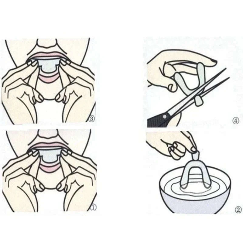 Anti Snoring Mouth Guard for Teeth Grinding Custom Fit Night Guard Set-2 PCS