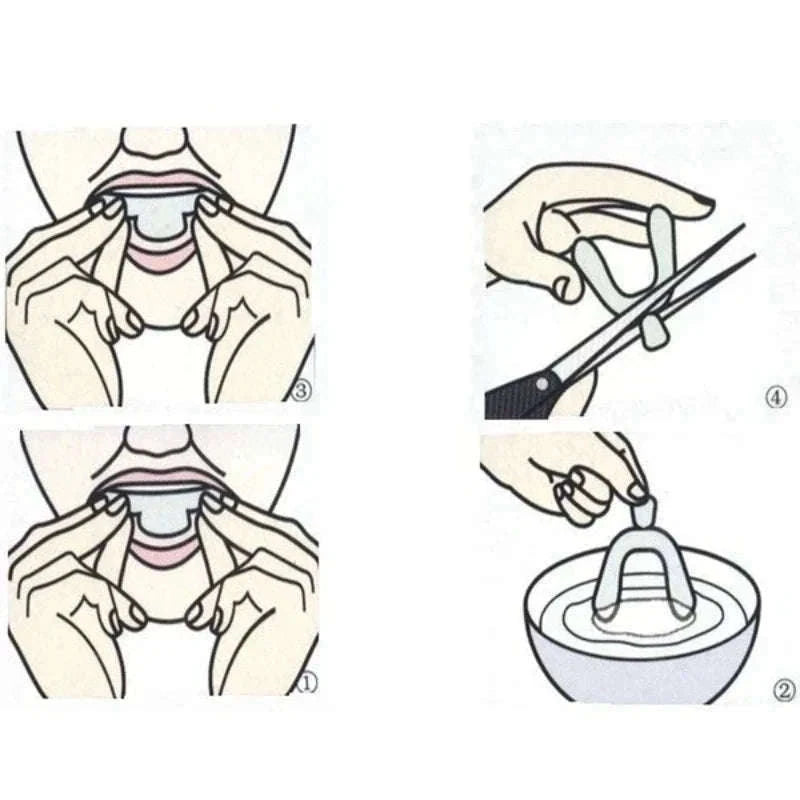 Anti Snoring Mouth Guard for Teeth Grinding Custom Fit Night Guard Set-2 PCS
