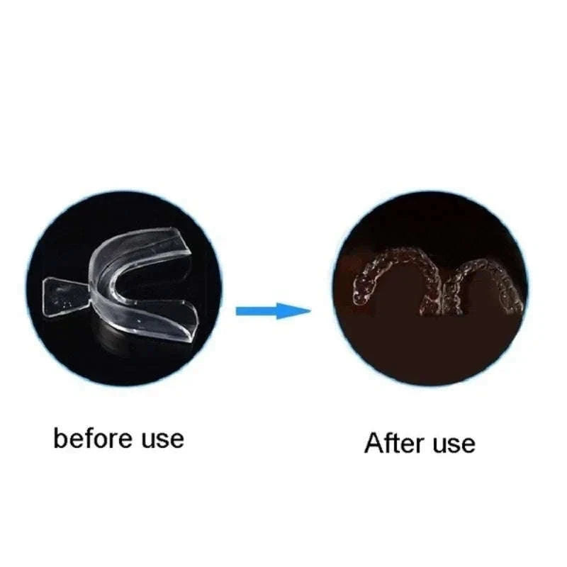 Anti Snoring Mouth Guard for Teeth Grinding Custom Fit Night Guard Set-2 PCS