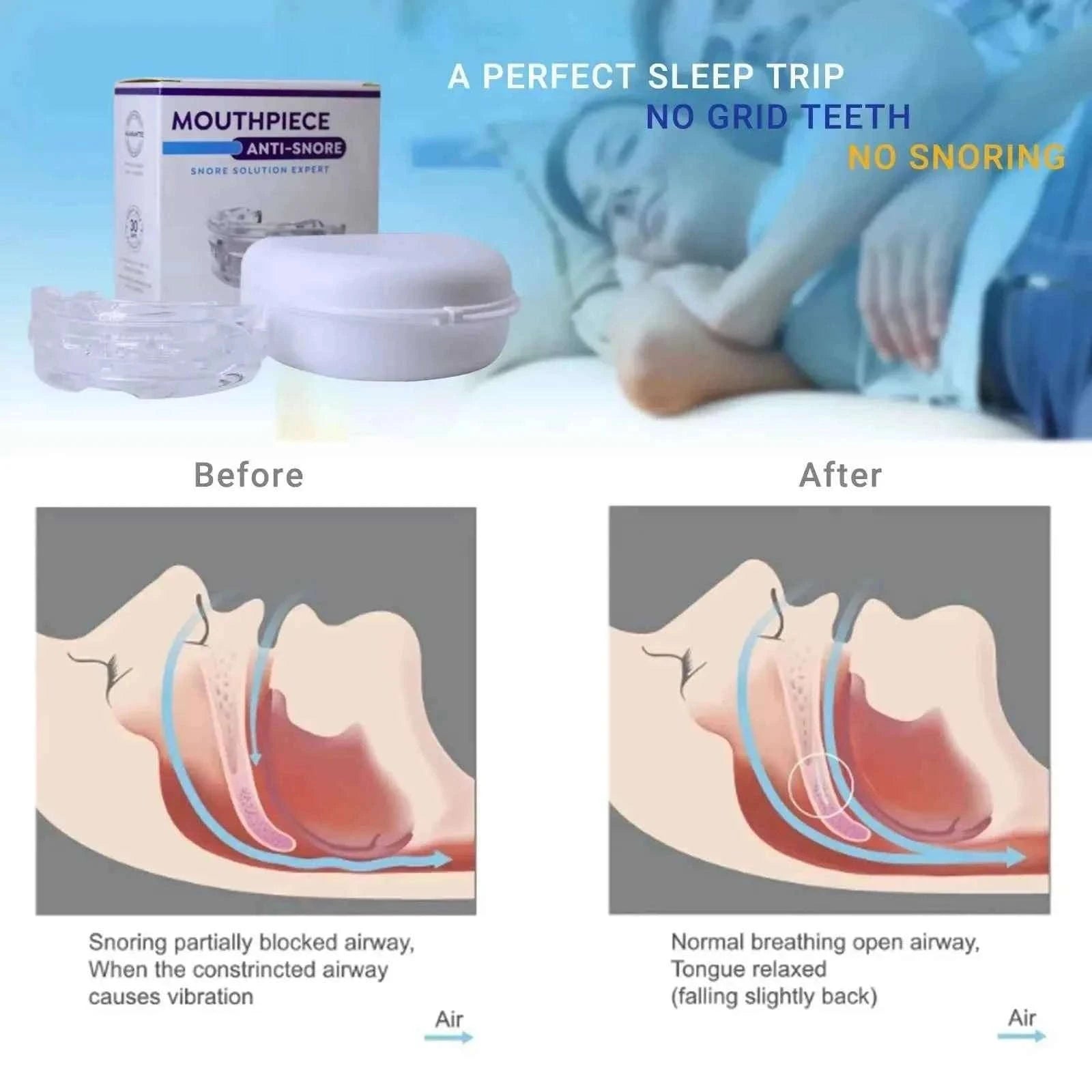 Anti-Snoring Mouthpiece for Teeth Grinding-4 pieces / China Mainland