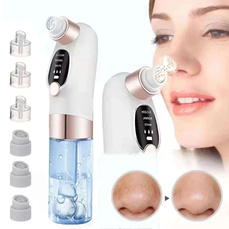 Blackhead Remover Vacuum with Water Cycle & USB Rechargeable-white add gift