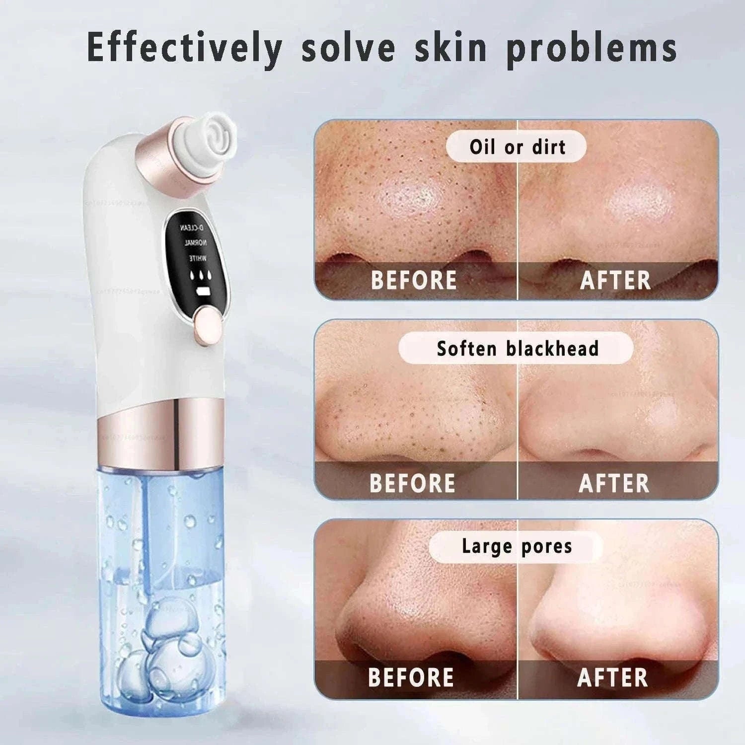 Blackhead Remover Vacuum with Water Cycle & USB Rechargeable-white add gift