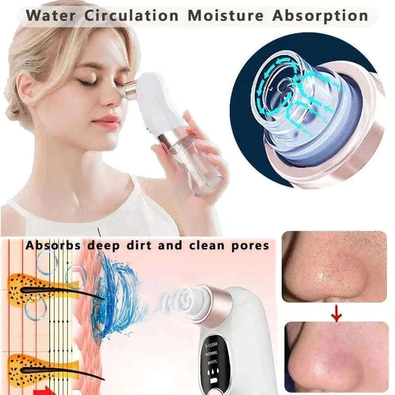 Blackhead Remover Vacuum with Water Cycle & USB Rechargeable-white add gift