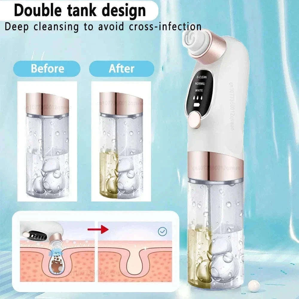 Blackhead Remover Vacuum with Water Cycle & USB Rechargeable-white add gift