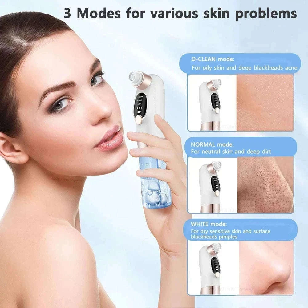 Blackhead Remover Vacuum with Water Cycle & USB Rechargeable-white add gift