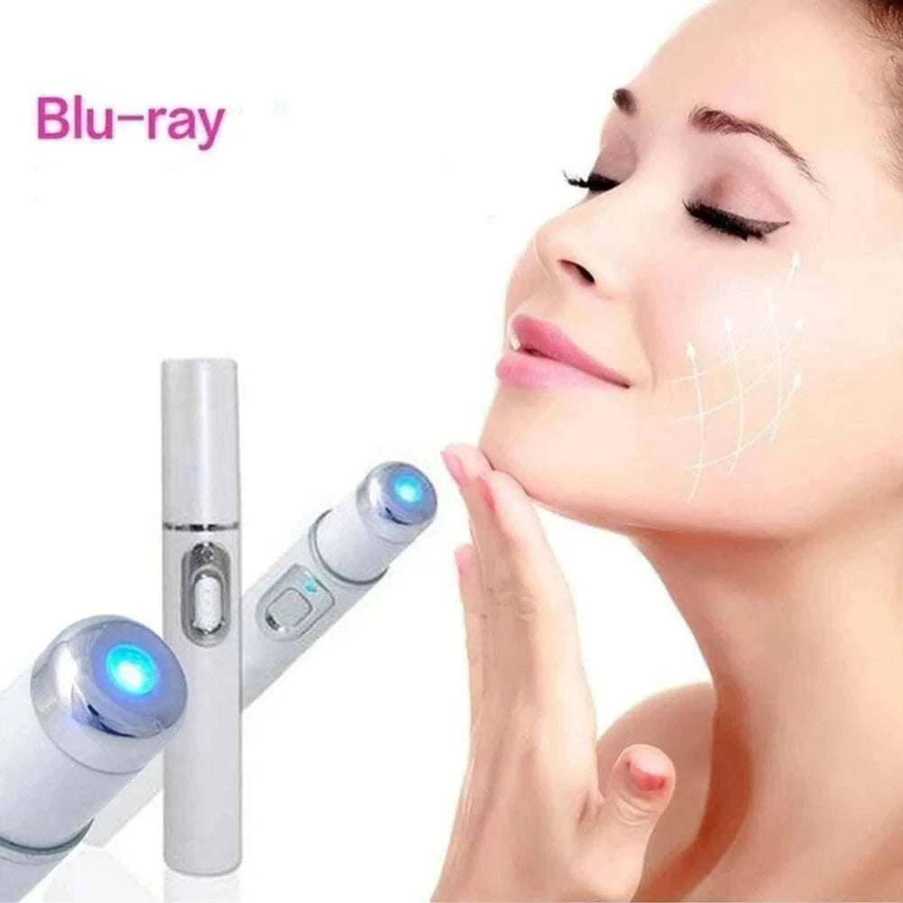 Blue Light Therapy Acne Pen for Targeted Blemish Care-1pc