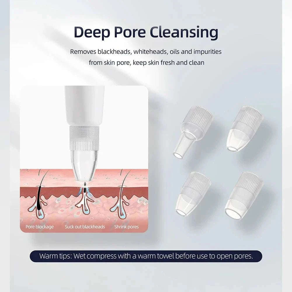 Diamond Microdermabrasion Machine for Deep Facial Exfoliation-US PLUG (100-110V)