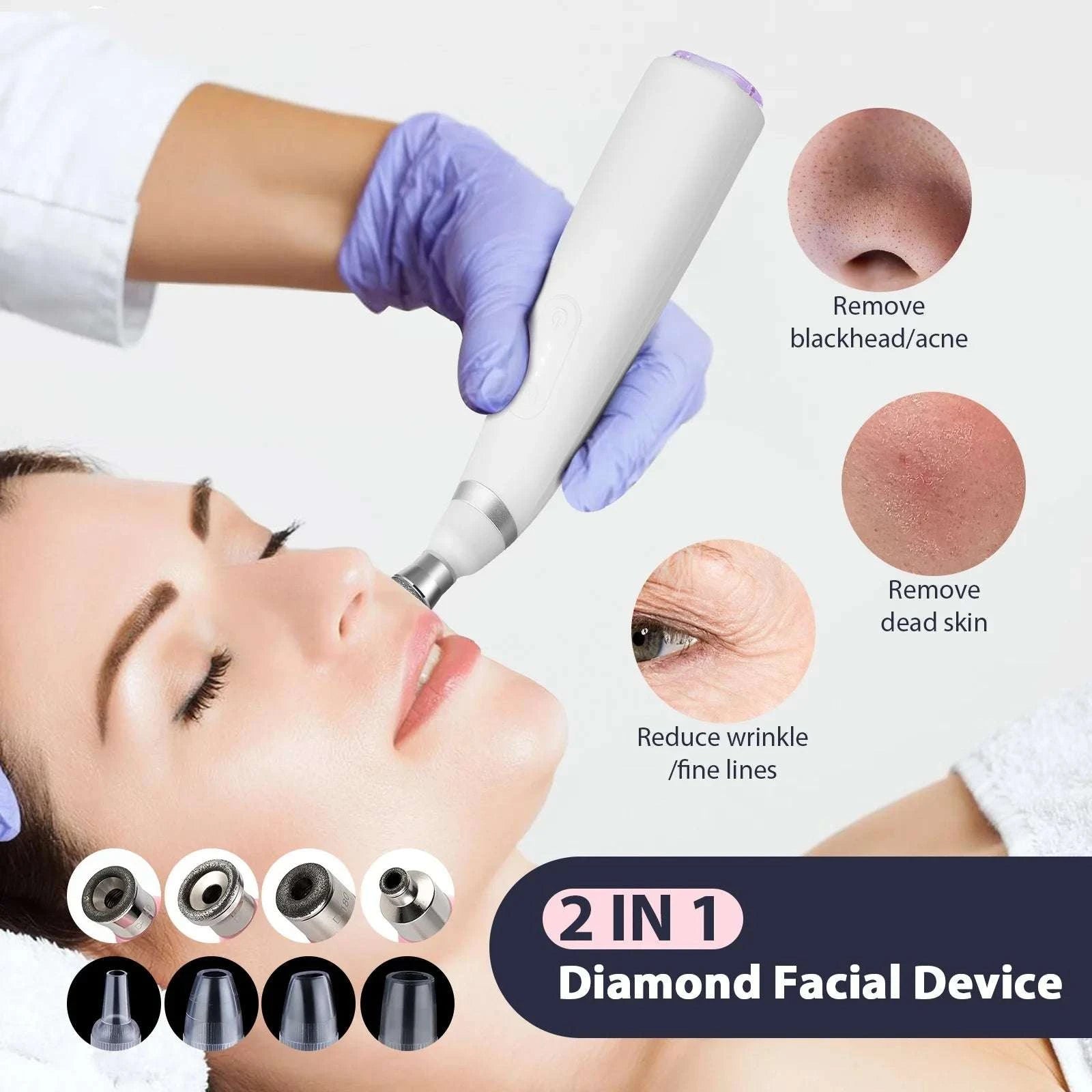 Diamond Microdermabrasion Machine for Deep Facial Exfoliation-US PLUG (100-110V)