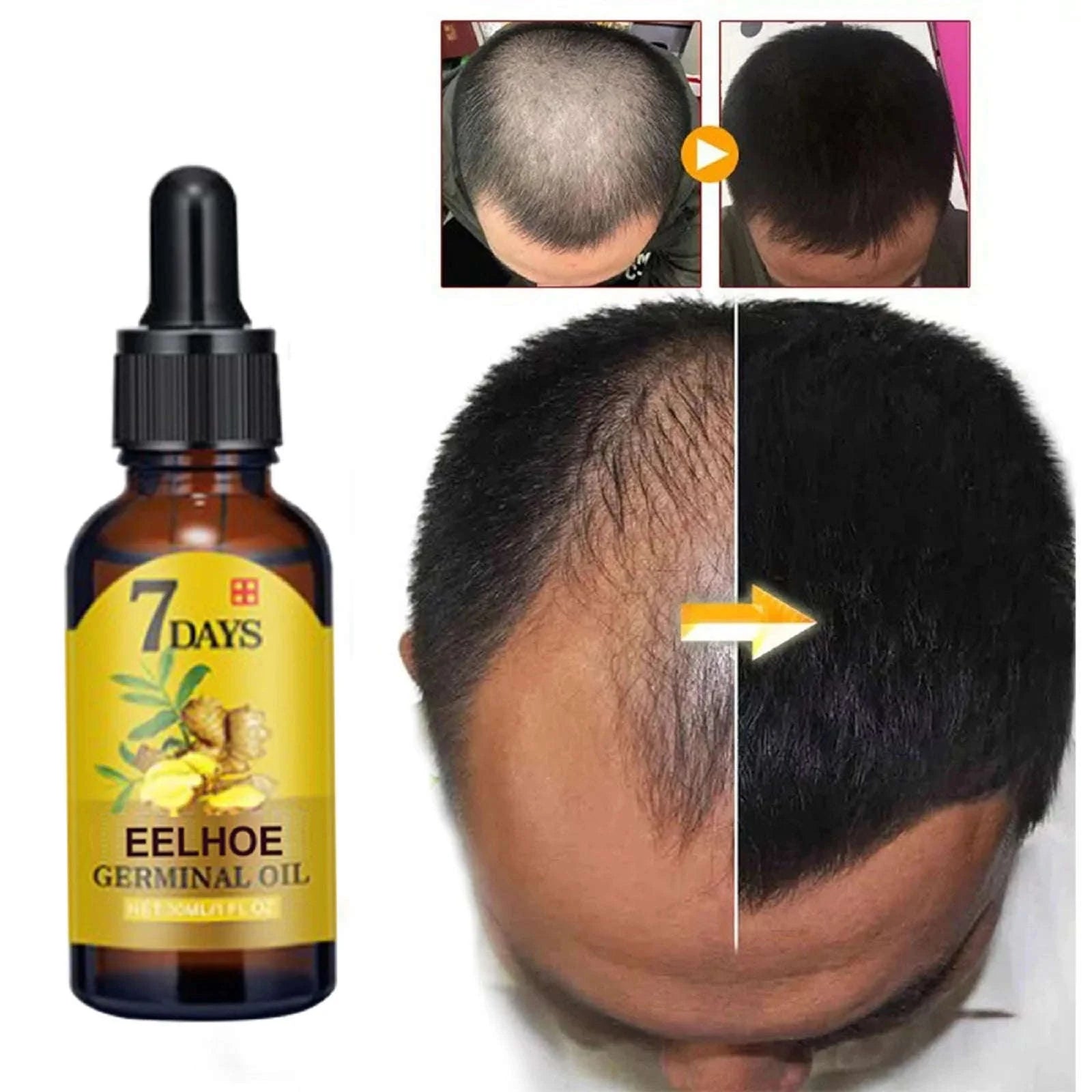 EELHOE 20ml Ginger Hair Growth Oil Strengthening Scalp Nourishing Hair Roots Anti Loss Fuller Care Hairs Essence for Women Men-1 Pc / United States