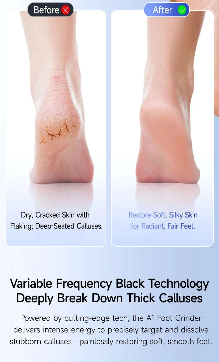 Electric Foot Callus Remover Kit Rechargeable Waterproof Pedicure Tool-black
