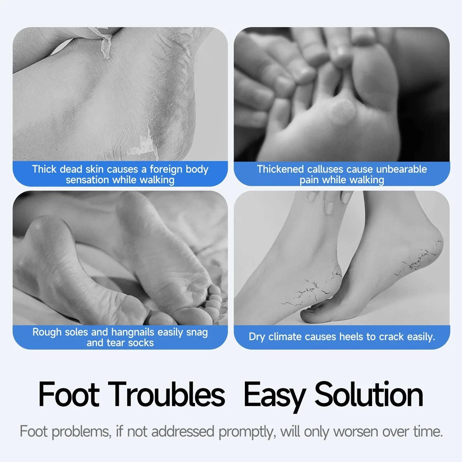 Electric Foot Callus Remover Kit Rechargeable Waterproof Pedicure Tool-black
