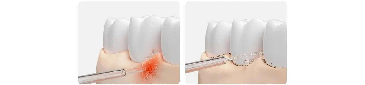 Electric Oral Irrigator with Bubble Pulse Cleaning & 90-Day Battery-Upgraded version