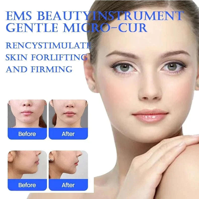 EMS Microcurrent Facial Massager for Lifting, Eye Care & Relaxation-United States / WHITE