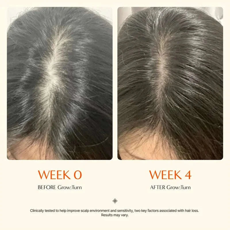 Hair Growth Serum Ampoule for Scalp Care, Anti-Hair Loss & Thinning Treatment, 100ml-United States