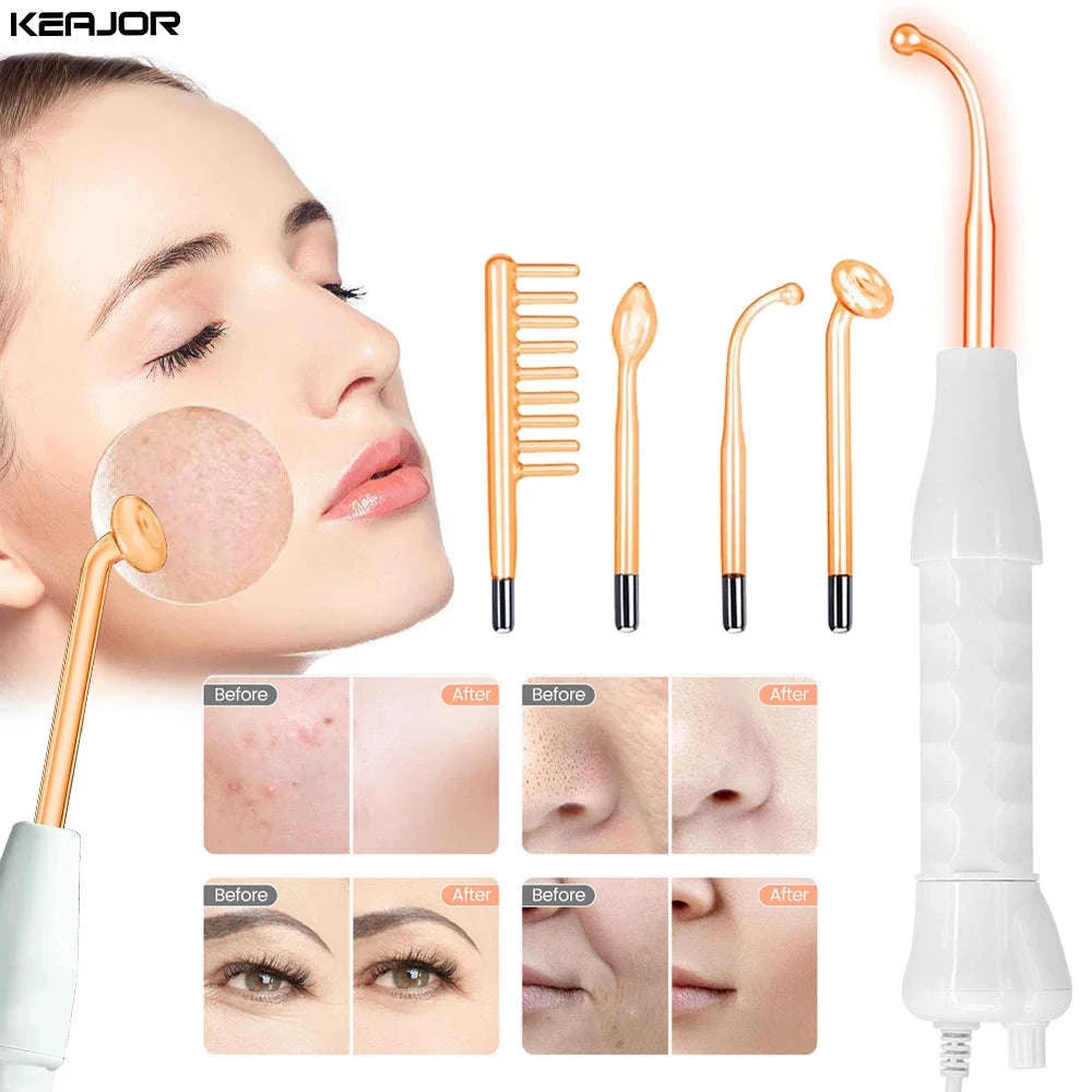 High Frequency Electrotherapy Facial Wand for Skin Rejuvenation-EU Plug