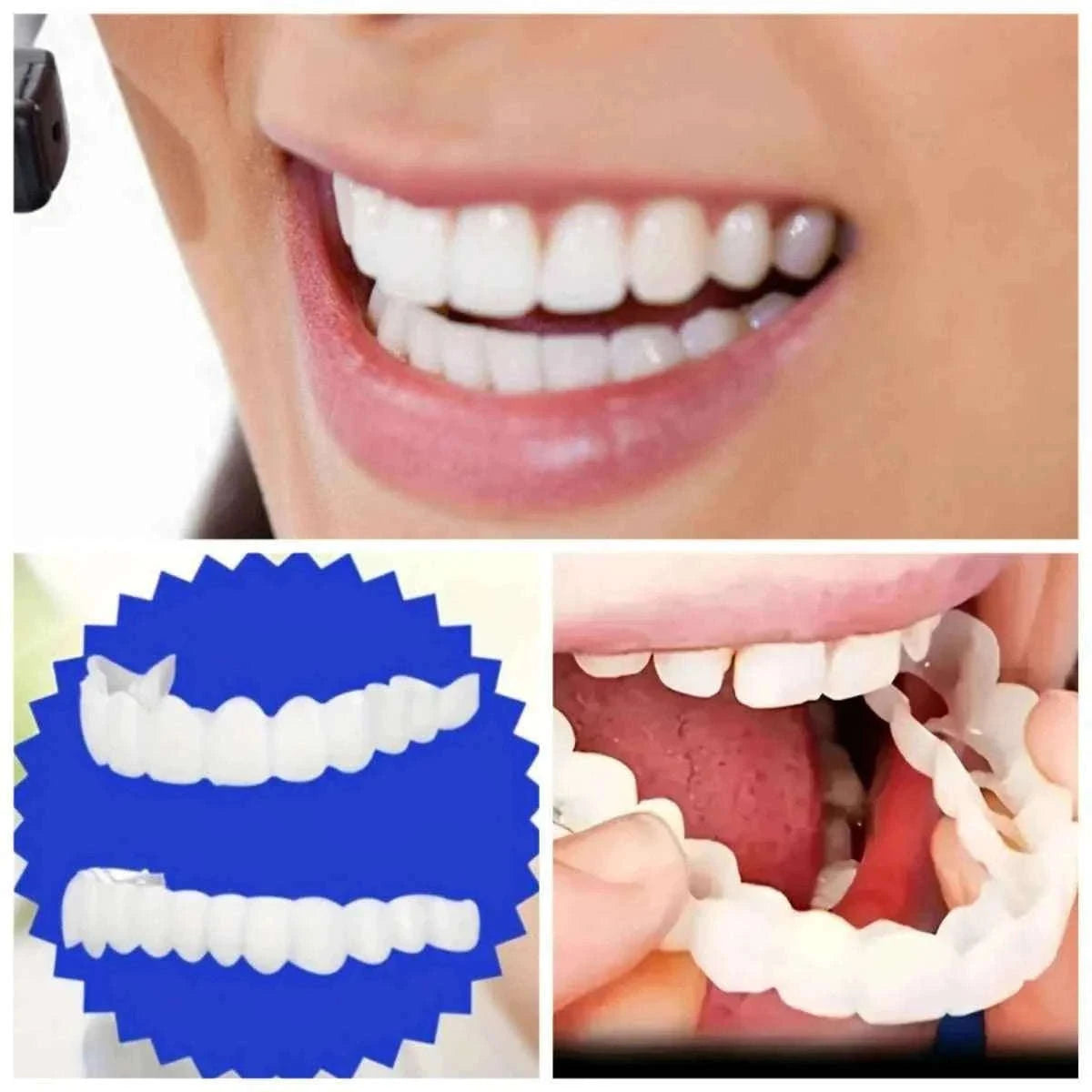 Invisible Fake Teeth Kit with Brush and Storage Box-2sets